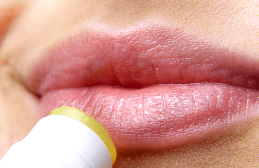Hyaluronic Acid For Lips